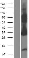 ASB9 Protein (Over-Expression Lysate Myc-DDK (Flag))