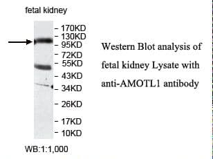 Polyclonal Rabbit anti-Human JEAP / AMOTL1 Antibody (C-Terminus, IHC, WB)