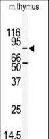 MARK2 Antibody (aa600-630)