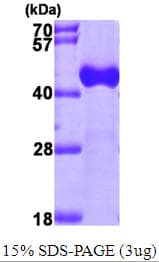 Human ACAA1 Protein (Recombinant His)