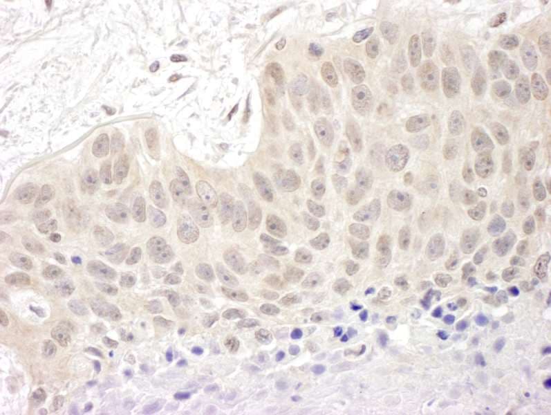 CUL5 / Cullin-5 Antibody (aa1-50)