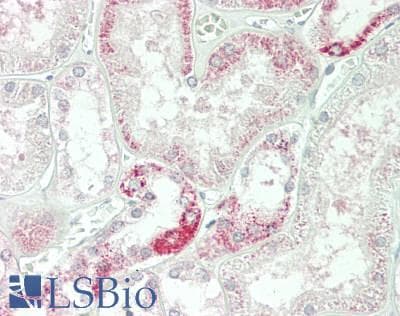 IHC-plus™ Polyclonal Rabbit anti-Human C1GALT1 Antibody (aa115-144, IHC, WB)
