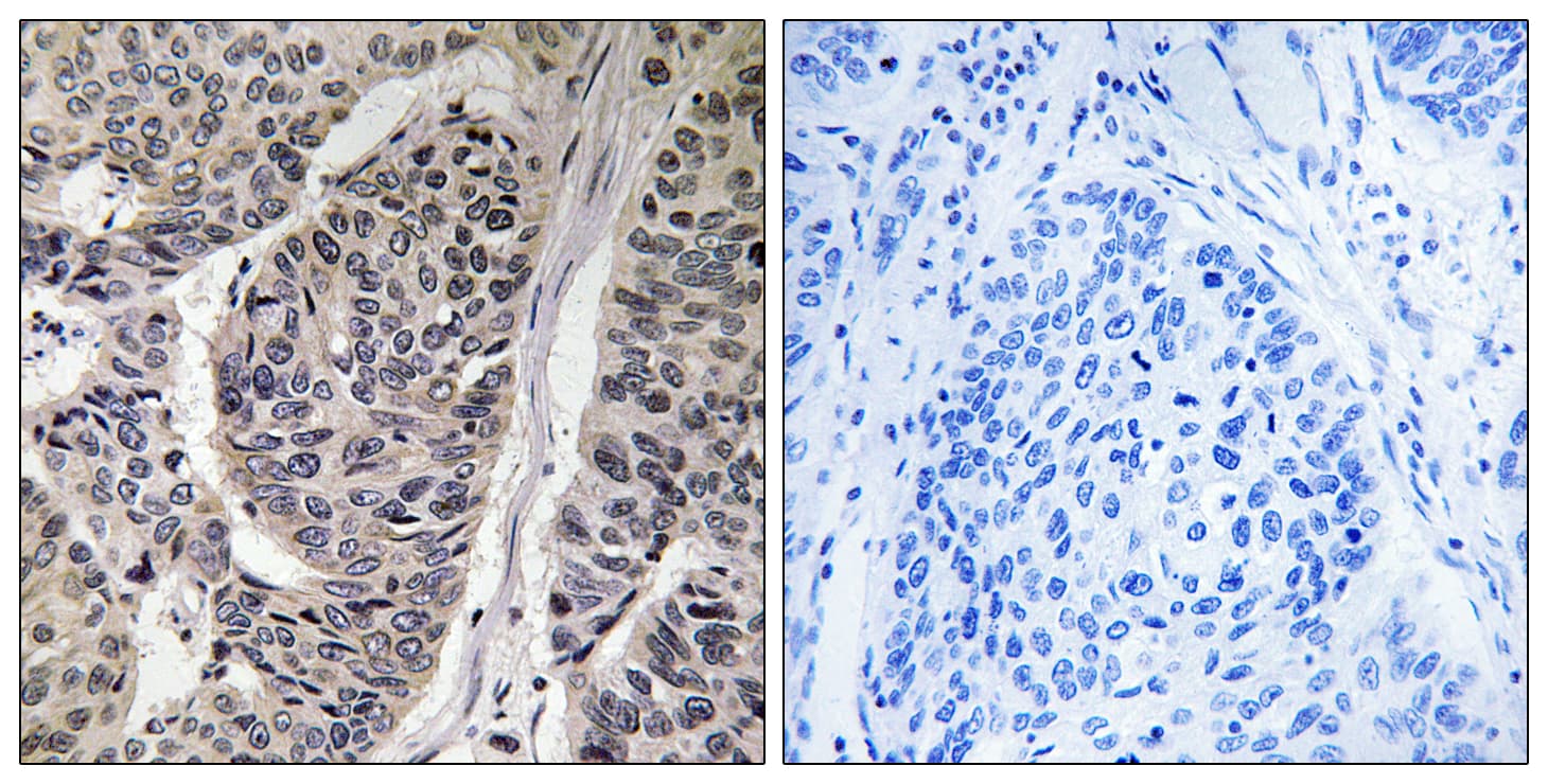 Polyclonal Rabbit anti-Human BCAR1 / p130Cas Antibody (phospho-Tyr410, IHC, WB)