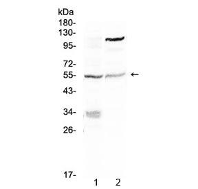 Polyclonal Rabbit anti-Human ETS1 / ETS-1 Antibody (WB)