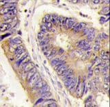 Polyclonal Rabbit anti-Human GOPC / PIST Antibody (aa164-193, IHC, WB)