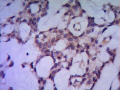 PPP1CA / PP1-Alpha Antibody