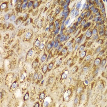 Polyclonal Rabbit anti-Human UGDH / UDPGDH Antibody (IHC, IF, WB)