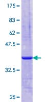 Human C25H / CH25H Protein (Recombinant GST, N-terminus)
