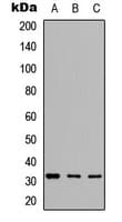 Polyclonal Rabbit anti-Human GCLM Antibody (Internal, IHC, WB)