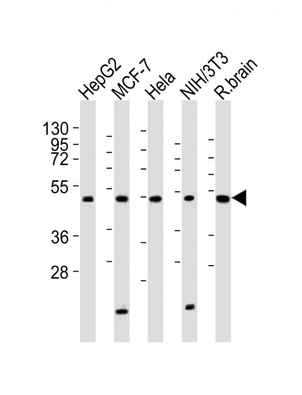 IHC-plus™ Polyclonal Rabbit anti-Human PPP2R2A Antibody (aa126-160, IHC, WB)