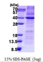 Human HAX-1 Protein (Recombinant His)