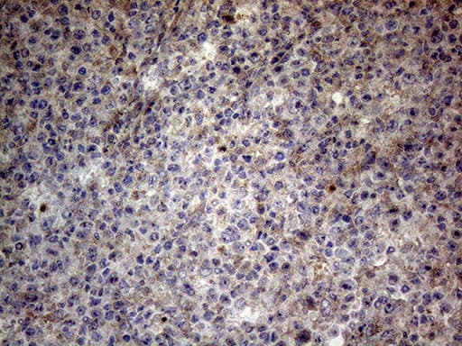 Monoclonal Mouse anti-Human CSF2 / GM-CSF Antibody (clone OTI10G3, aa18-144, IHC, WB)