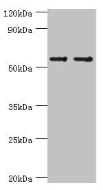 Polyclonal Rabbit anti-Human SLC2A1 / GLUT-1 Antibody (aa210-310, IHC, WB)