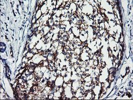 ERBB2 / HER2 Antibody (aa676-1255, clone OTI9G2, Carrier-free)