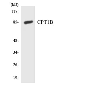 Polyclonal Rabbit anti-Human CPT1B Antibody (aa387-436, IHC, WB)