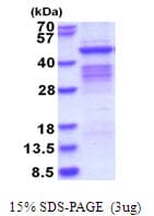 Human PSG1 / CD66f Protein (Recombinant His)