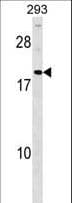 HDGFRP3 Antibody (aa15-44)