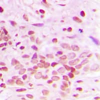 XRCC6 / Ku70 Antibody (C-Terminus)