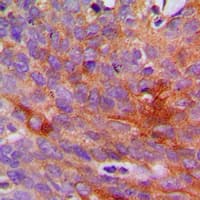 COL1A2 / Collagen I Alpha 2 Antibody (N-Terminus)