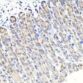 Polyclonal Rabbit anti-Human MAPKBP1 Antibody (IHC, WB)