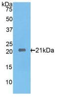 IL17RE Antibody (aa457-626)