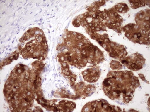 FMO3 Antibody (aa1-291, clone OTI3H1)