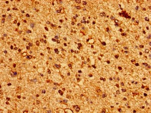 Polyclonal Rabbit anti-Human HLA Class I Histocompatibility Antigen, C-4 Alpha Chain Antibody (IHC, WB)