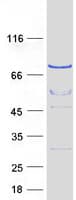Human APC6 / CDC16 Protein (Recombinant Myc-DDK (Flag))