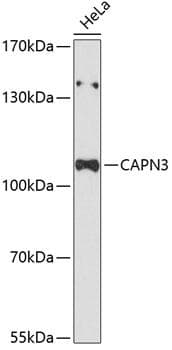 CAPN3 / Calpain 3 Antibody