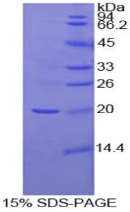 Human IL18 Protein (Recombinant His)