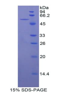 Mouse BACE1 / BACE Protein (Recombinant His-GST)