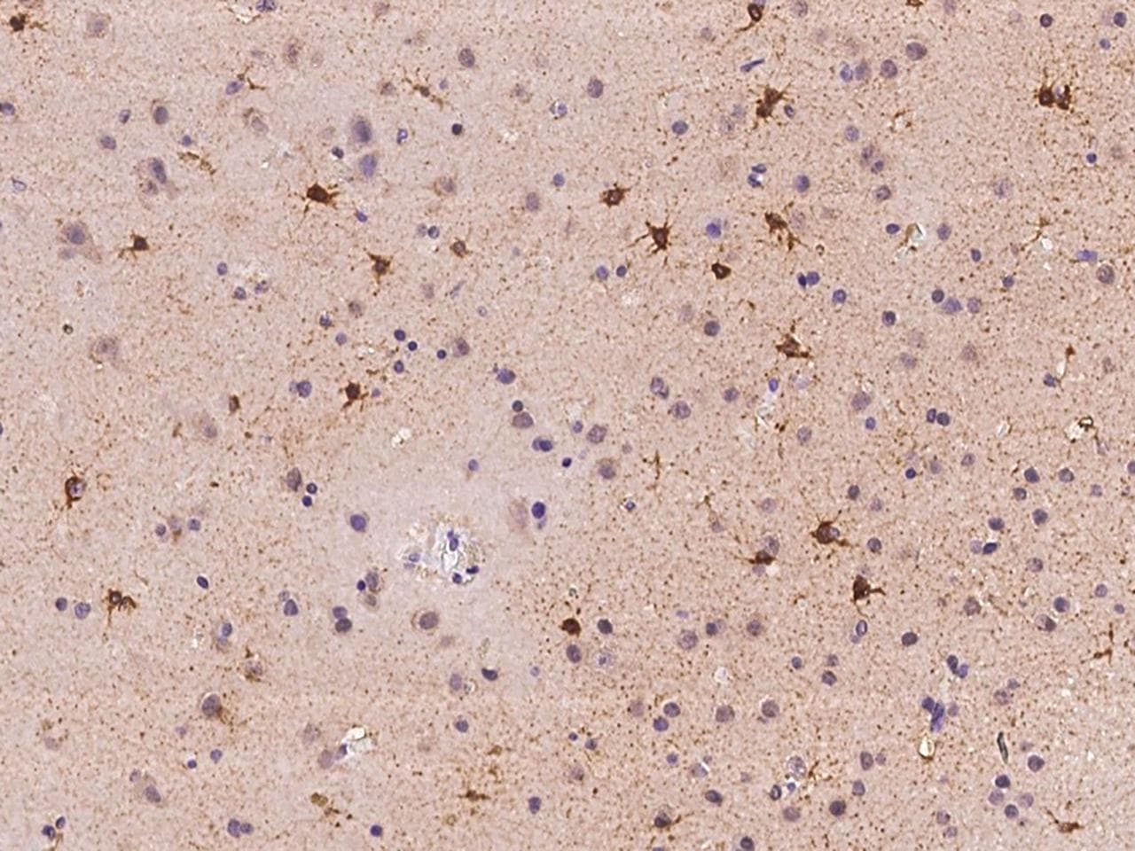 ACSBG1 / hsBG Antibody