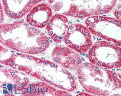 IHC-plus™ Polyclonal Rabbit anti-Human SCN9A / Nav1.7 Antibody (IHC)