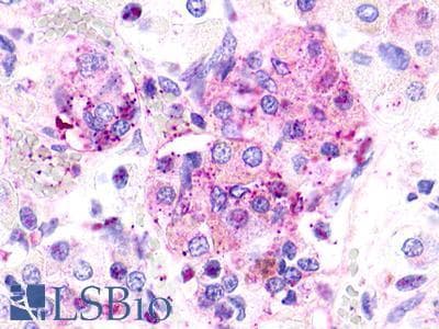 PathPlus™ Polyclonal Rabbit anti-Human CRHR2 / CRF2 Receptor Antibody (Extracellular Domain, IHC)