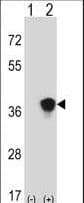 MAP2K3 / MEK3 / MKK3 Antibody (aa132-160)