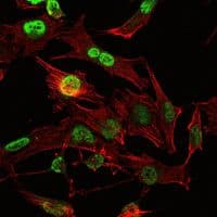OTX2 Antibody (clone 1H12G8B2)