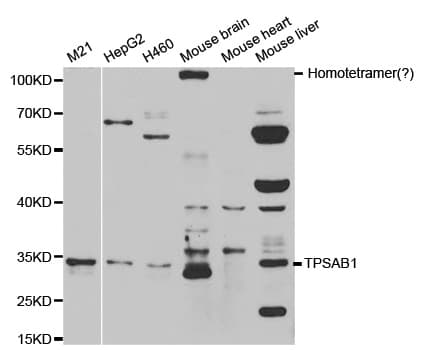 TPSAB1 / Mast Cell Tryptase Antibody