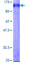 Human DATF1 / DIDO1 Protein (Recombinant GST)