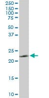 IHC-plus™ PGRMC2 Antibody (clone 3C11)