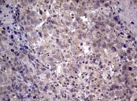 AFAP1 / AFAP Antibody (aa100-386, clone OTI2G9)