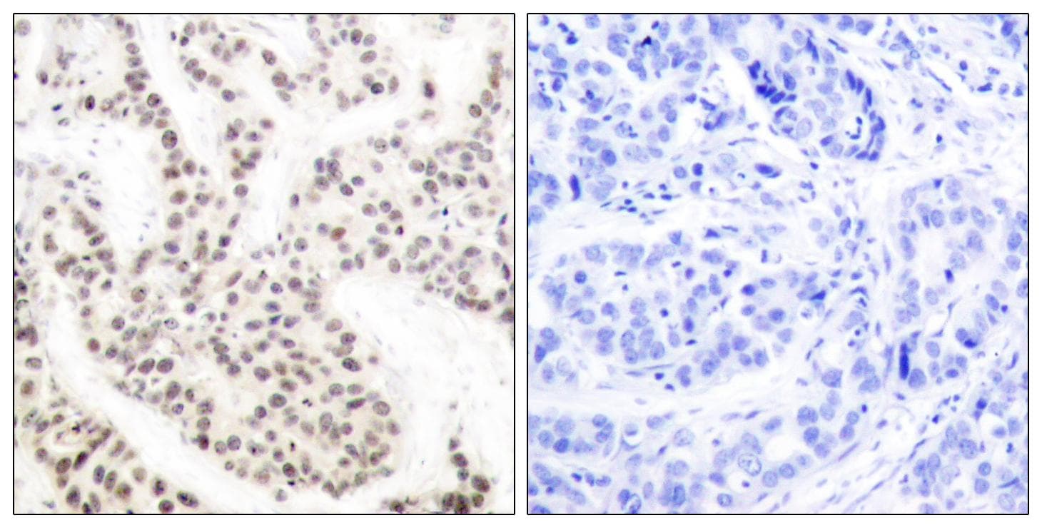 ELK1 Antibody (phospho-Thr417)