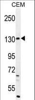 Polyclonal Rabbit anti-Human DUOX2 Antibody (aa513-542, WB)