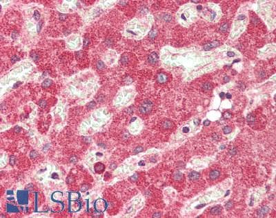 IHC-plus™ Polyclonal Rabbit anti-Human PTPRF Antibody (IHC, WB)