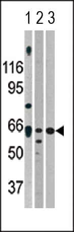 PathPlus™ Polyclonal Rabbit anti-Human ACVR2 / ACVR2A Antibody (aa2-29, IHC, WB)