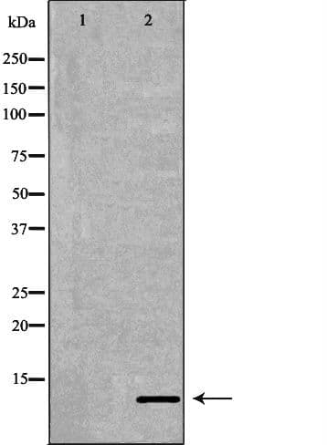 Neuropeptide Y / NPY Antibody