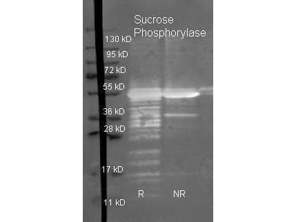 Sucrose Phosphorylase Antibody