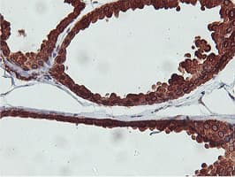 APMAP / C20orf3 Antibody (clone OTI3F2)