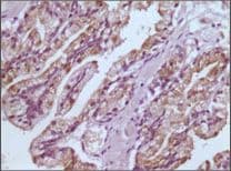 GSTP1 / GST Pi Antibody (clone 3F2C2)