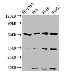 Polyclonal Rabbit anti-Human NAGPA Antibody (IHC, WB)