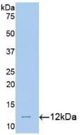 MTNR1A / Melatonin Receptor 1a Antibody (aa300-353)